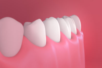 Tips For Preventing Gum Disease From Arc Advanced Dentistry &#   ; Cosmetics