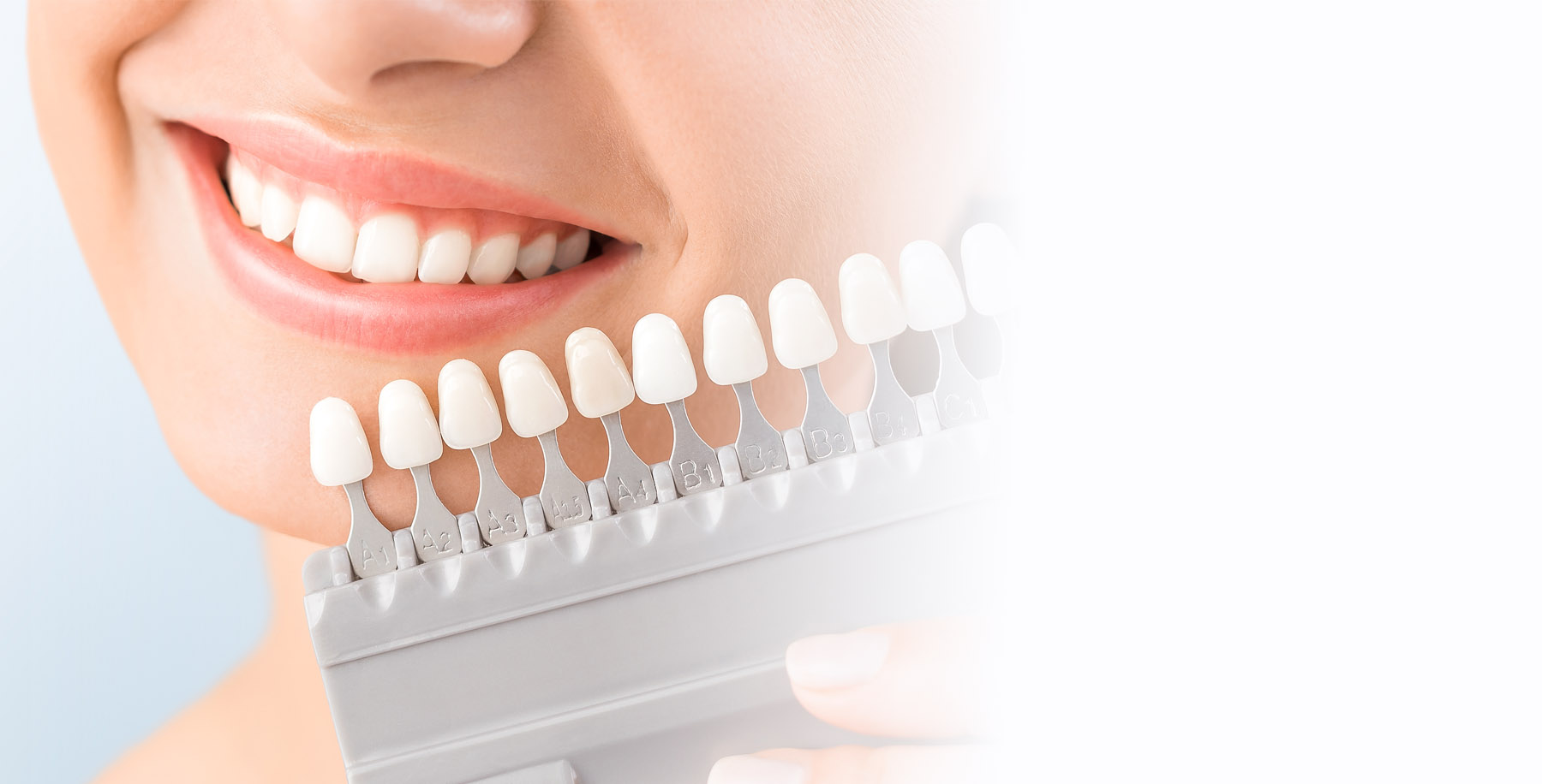 Special pricing available for Teeth whitening