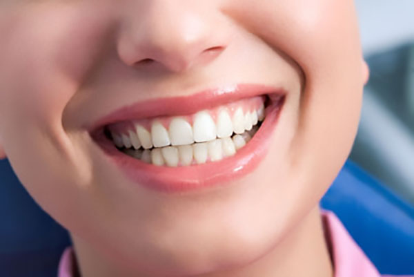 Why Is It Important To Go In For Professional In Office Teeth Whitening?